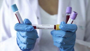 Koronavirüsün tedavisi için tüm dünya aşı çalışmalarını hızla yürütürken, bu