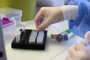 MANİSA (AA) – Manisa Celal Bayar Üniversitesi (MCBÜ) Tıp Fakültesi