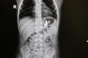 DENİZLİ (AA) – SEBAHATDİN ZEYREK – Denizli'deki Pamukkale Üniversitesi Hastanesinde