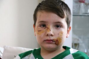 MANİSA (AA) – Manisa'nın Yunusemre ilçesinde evinin önünde sokak köpeğinin