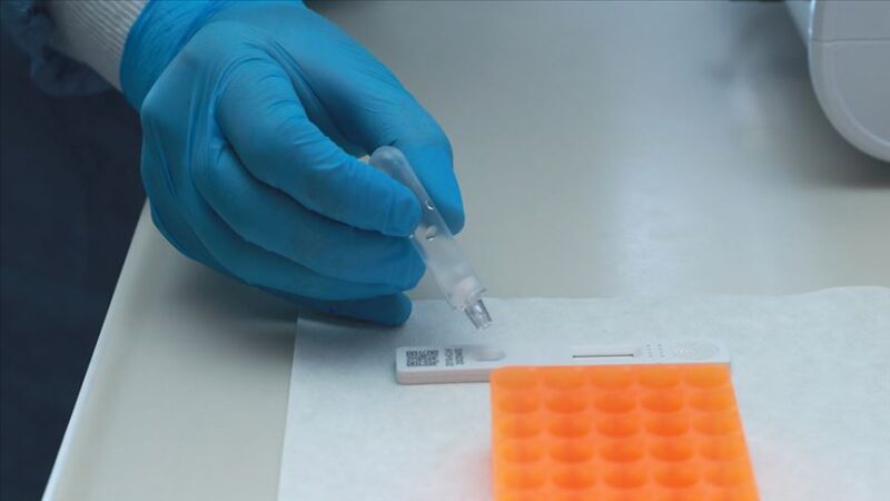 PCR testi yerine “hızlı antijen kiti” için Sağlık Bakanlığı’ndan onay bekleniyor