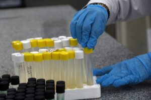 ANTALYA (AA) – ZEHRA TEKECİ – Akdeniz Üniversitesi Verem Çalışmaları