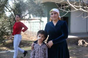 MARDİN (AA) – Mardin'in Derik ilçesinde sokak köpeklerinin saldırısında yaralanınca