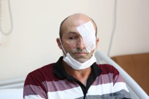 TRABZON (AA) – Trabzon'da, geçirdiği kaza sonucu sol gözünde yüzde