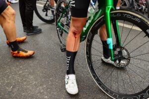 İSTANBUL (AA) – 57. Cumhurbaşkanlığı Türkiye Bisiklet Turu (Tour of