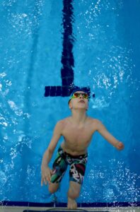 ESKİŞEHİR (AA) – DENİZ AÇIK – Eskişehir'de, doğuştan sol kolunun