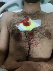 - Avrupa'ya gitmeye çalışan Afganistan uyruklu 2 kişi, plastik merminin