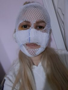 - Eski erkek arkadaşının yüzüne attığı kimyasal madde nedeniyle yaralanan