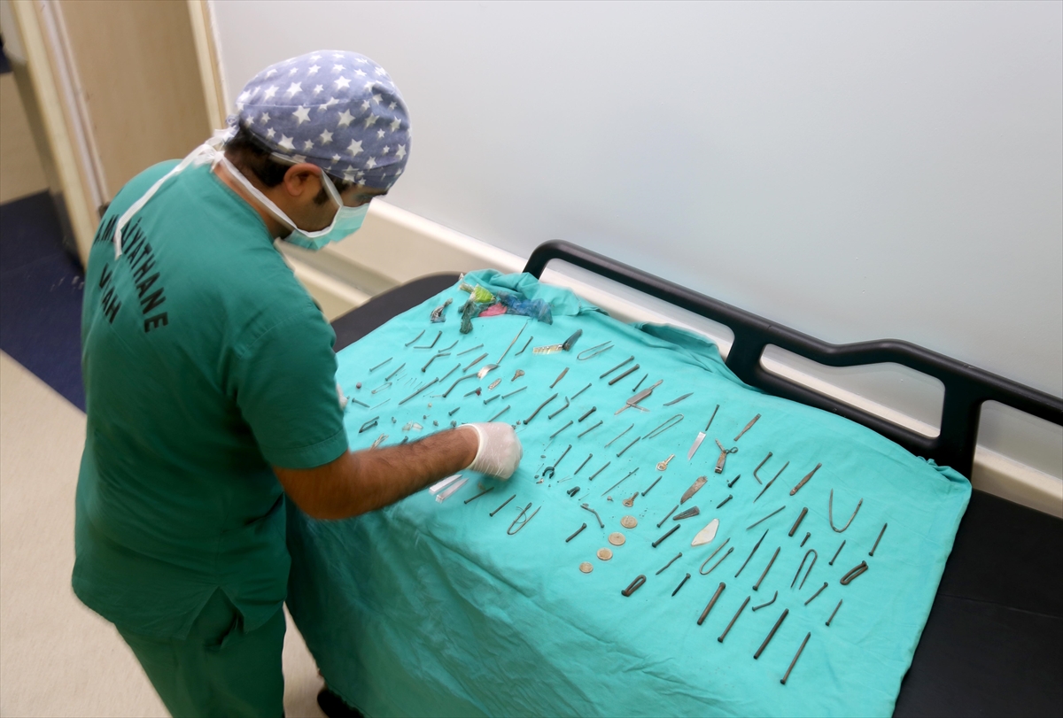 Van'da kadın hastanın midesinden 158 yabancı cisim çıkarıldı
