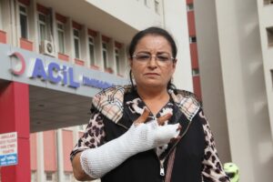 AYDIN (AA) – Aydın'ın Söke ilçesinde tasmasız dolaştırılan köpeğin saldırdığı