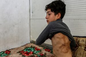 AZEZ/ANKARA (AA) – ÖMER KOPARAN/ETHEM EMRE ÖZCAN – İç savaşın