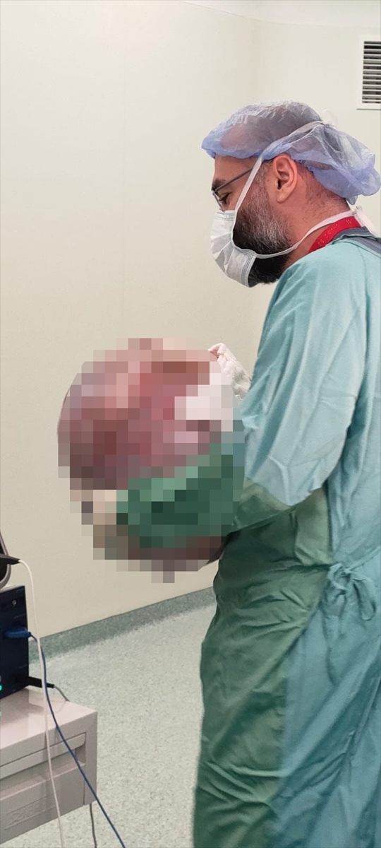 Tekirdağ'da bir hastanın karnından 35 kilogramlık kitle çıkarıldı