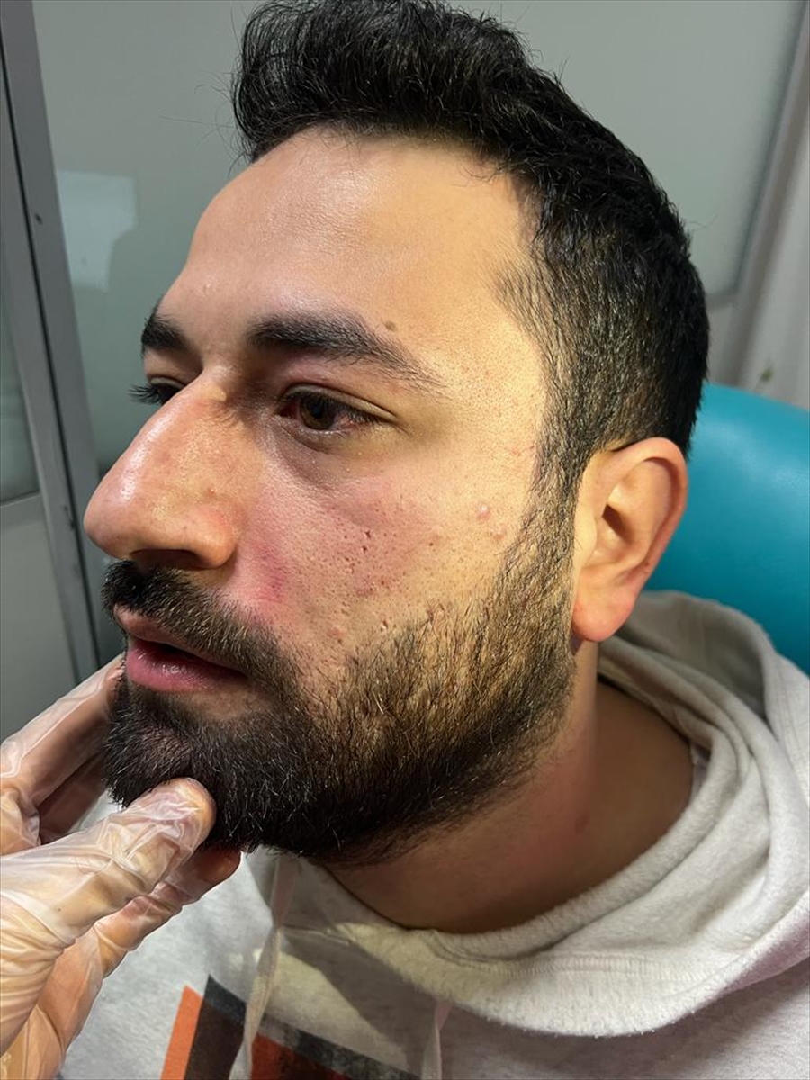 Elazığ'da doktoru darbeden 1 kişi yakalandı