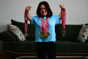 ESKİŞEHİR (AA) – ATAHAN GEZER – Eskişehir'de doğuştan akondroplazi rahatsızlığı