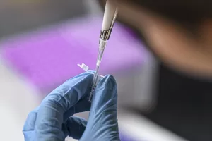 ANKARA (AA) – BURCU ÇALIK- Avrupa Tıp Uzmanları Birliği Nadir