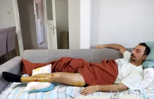 İSTANBUL (AA) – Beylikdüzü'nde pitbull cinsi köpeğin saldırısına uğrayan kişi