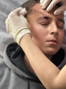 ANKARA (AA) – Ankara'nın Gölbaşı ilçesinde sahipsiz köpekten kaçarken bina