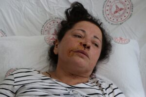 NİĞDE (AA) – Niğde'de sahipli 2 köpeğin saldırısında yaralanan kadın,