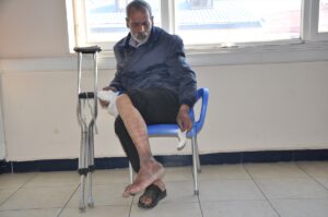 - Bastonsuz yürüyemediğini belirten dilencinin, zabıta karakolunda bacağını rahatlıkla hareket