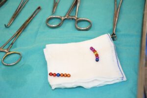 YOZGAT (AA) – Yozgat'ta 4 yaşındaki çocuğun bağırsağından yuttuğu 13