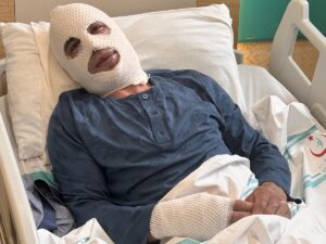 ERZURUM (AA) – Erzurum'da soğuktan donduğunu düşündüğü için ocakta ısıttığı