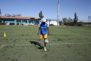 ŞANLIURFA (AA) – MÜSLÜM ETGÜ – Çocukluğunda yaşadığı kaza sonucu