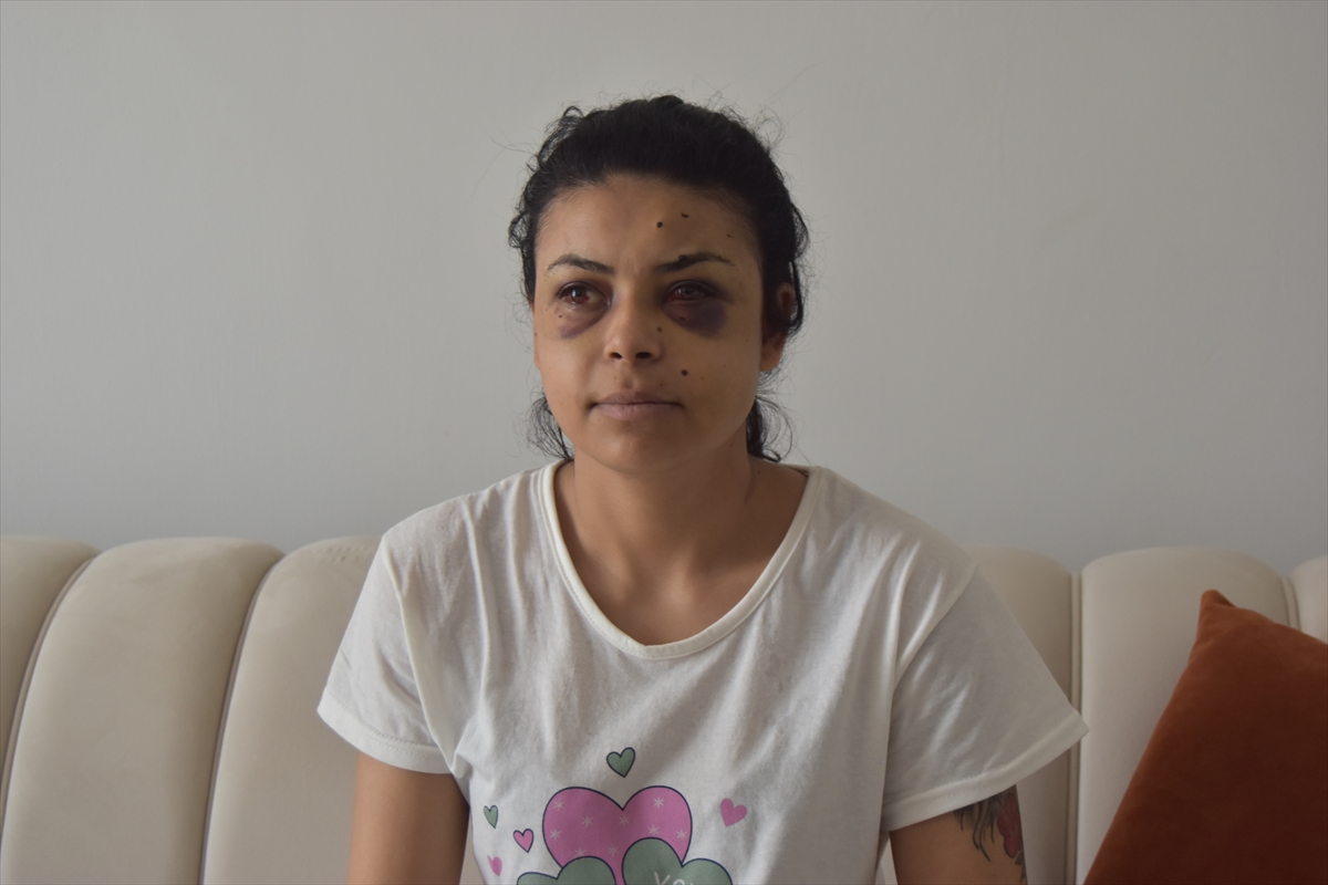 Kırklareli'nde bir kadın, düğündeki kavgada tüfekten çıkan saçmalarla gözünden yaralandı