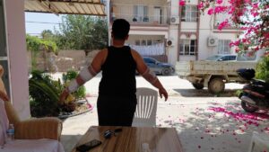 HATAY (AA) – Hatay'ın Samandağ ilçesinde, sahipsiz köpeğin saldırısına uğrayan