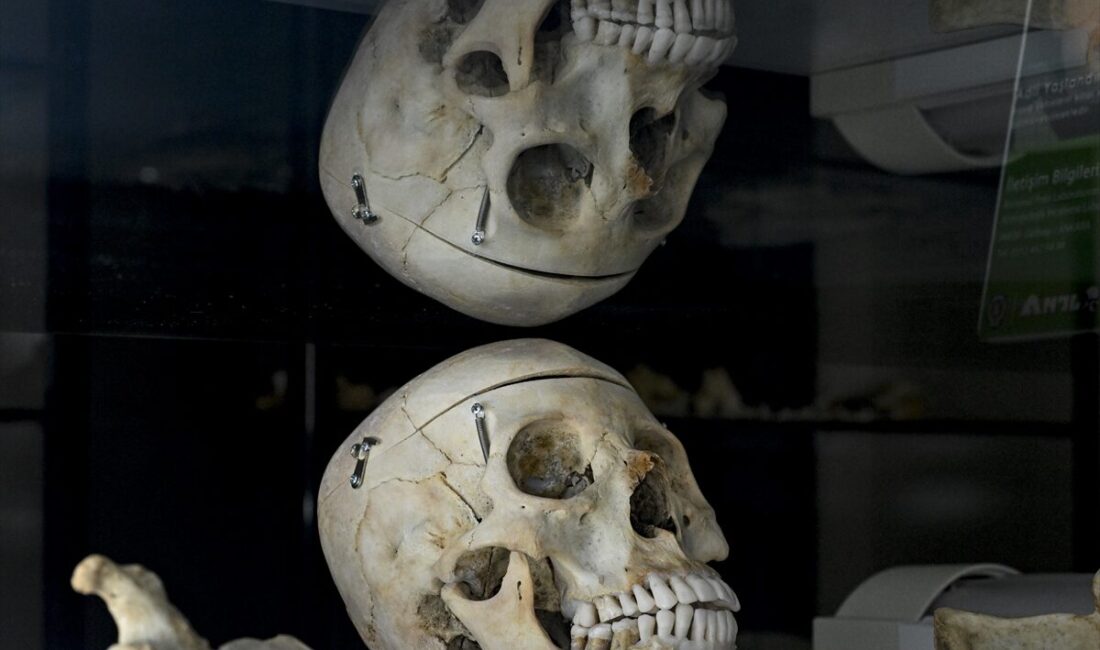 - "İskelet incelemesi", "adli yaşlandırma" ve "yeniden yüzlendirme"nin gerçekleştirildiği Kriminal