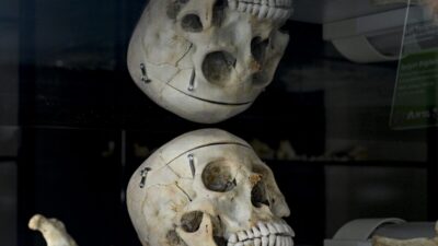 - "İskelet incelemesi", "adli yaşlandırma" ve "yeniden yüzlendirme"nin gerçekleştirildiği Kriminal