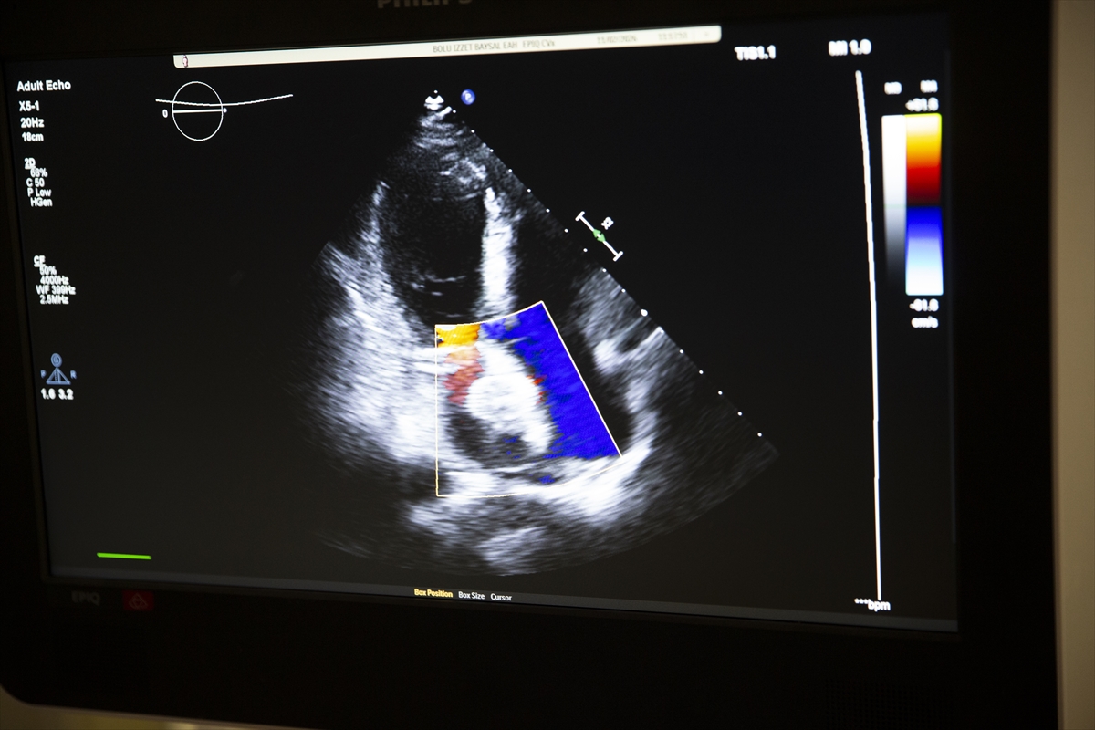 - Yorgunluk, nefes darlığı ve uykusuzluk şikayetiyle hastaneye başvuran 45
