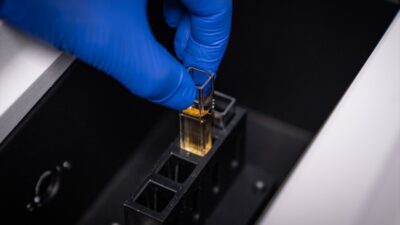 - Tıbbi Mikrobiyoloji Biyoteknoloji Uzmanı Prof. Dr. Avcı:
- "Moleküler çalışmalar