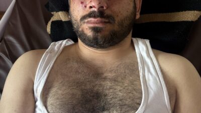 LAZKİYE (AA) – Suriye ordusunun mayın temizleme çalışmaları sırasında meydana