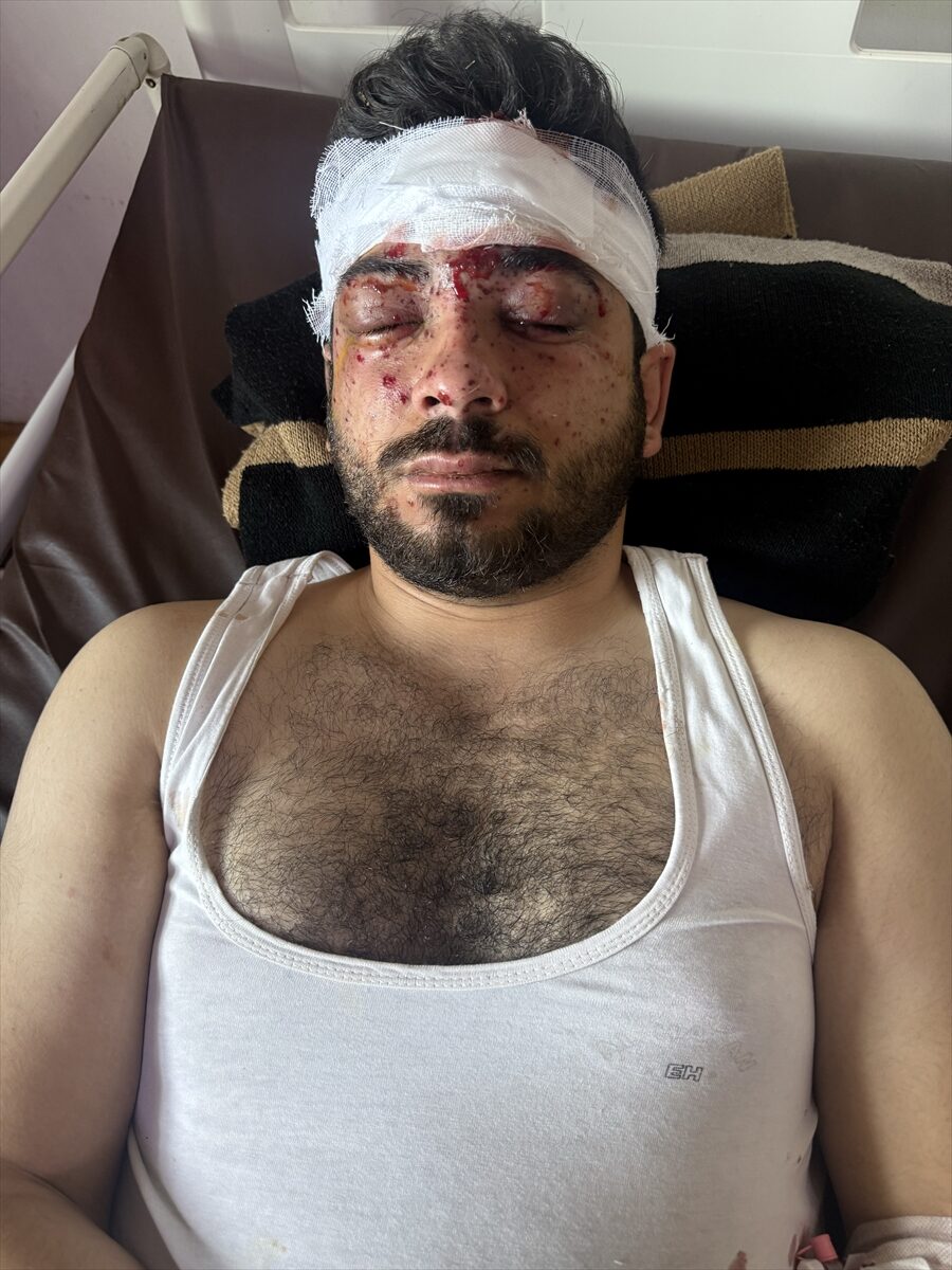 LAZKİYE (AA) – Suriye ordusunun mayın temizleme çalışmaları sırasında meydana